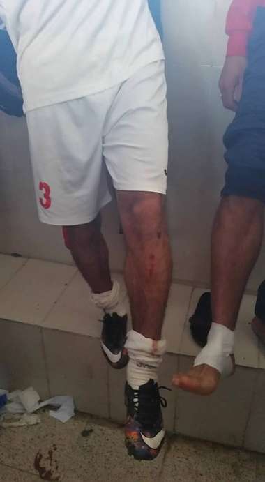 لاعب اتحاد عنابة بوقطوش