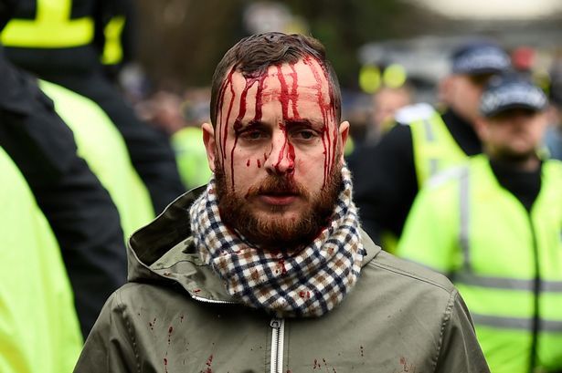 Crowd-trouble-at-TottenhamjpG