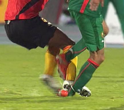 التدخل الذي أصيب من خلاله الأحمدي