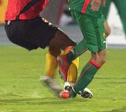 التدخل الذي أصيب من خلاله الأحمدي