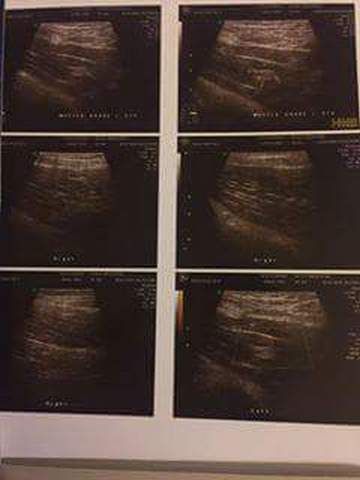 received_10155067917882366