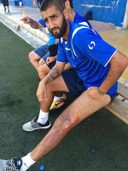 آثار الحادث على قدم السعدي