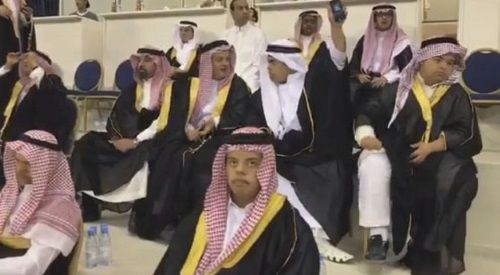 أطفال جمعية داون