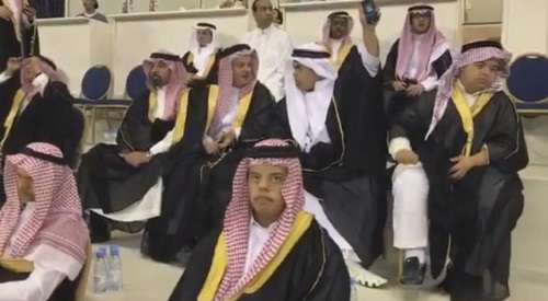 أطفال جمعية داون