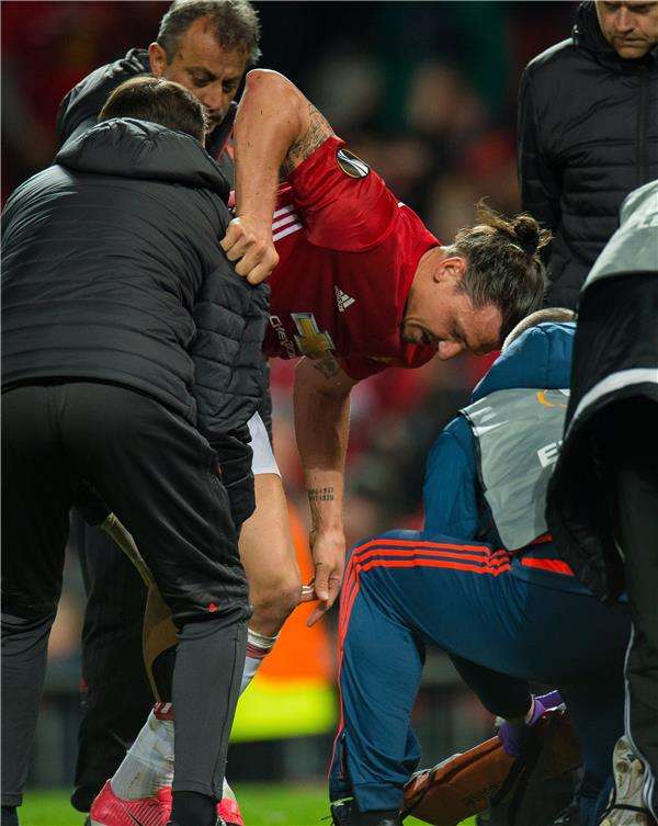 إبراهيموفيتش تعرض لإصابة قوية