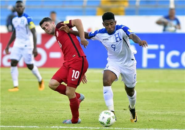 أنطوني لوزانو 