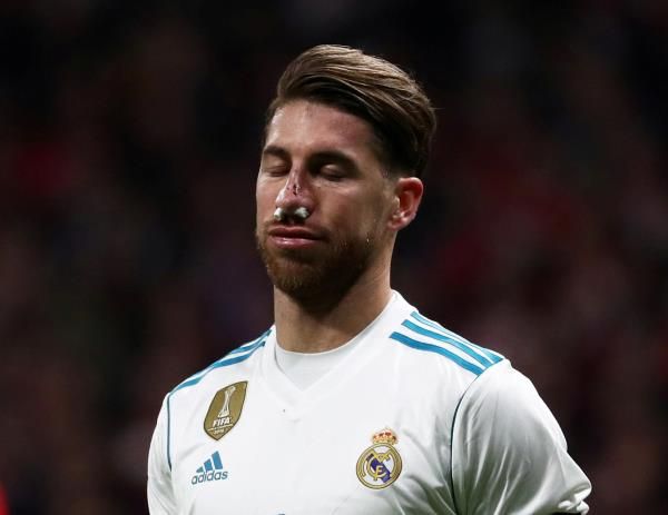 راموس بعد الإصابة