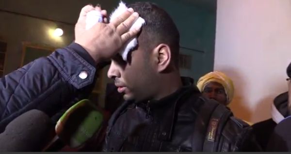 جانب من إصابة الصحفي الجزائري