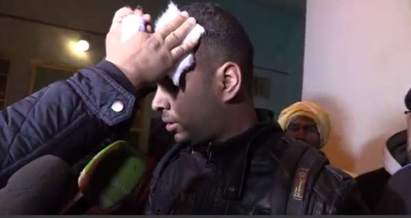 جانب من إصابة الصحفي الجزائري