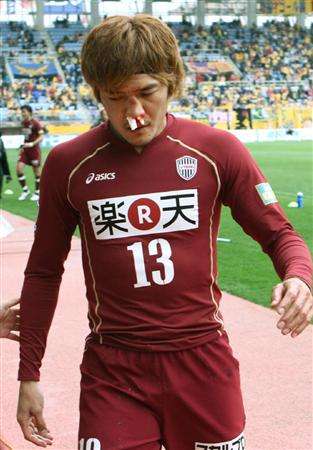 يوشيتو أوكوبو ينزف دماً من أنفه المكسور بعد نهاية المباراة