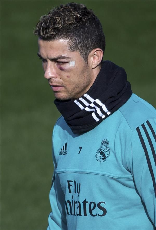 إصابة رونالدو