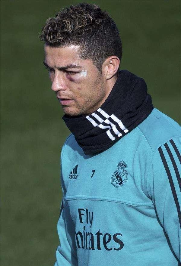 إصابة رونالدو