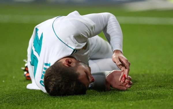 لحظة إصابة هيرنانديز