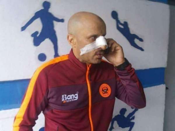 الجعواني بعد تعرضه لاعتداء بين الشوطين