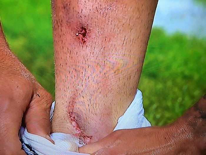 31369210_977436852414612_6135145784863096832_n