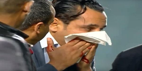 أيمن شندول بعد الاعتداء