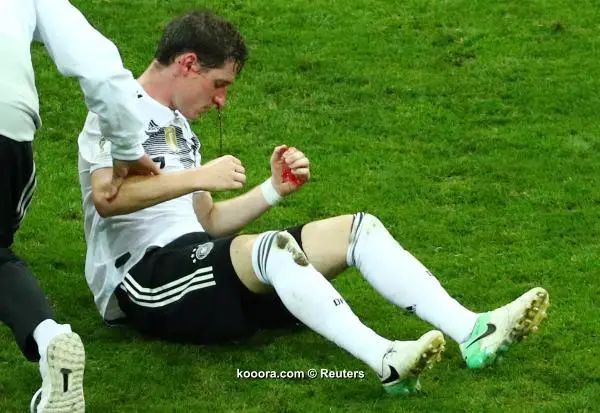 ?i=reuters%2f2018-06-23%2f2018-06-23t182914z_2076706229_rc180669f0a0_rtrmadp_3_soccer-worldcup-ger-swe_reuters