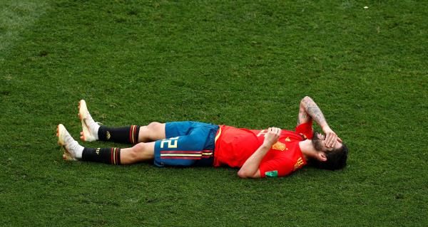 إيسكو عقب الخسارة