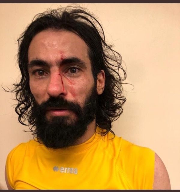 حسين عبد الغني بعد المشاجرة