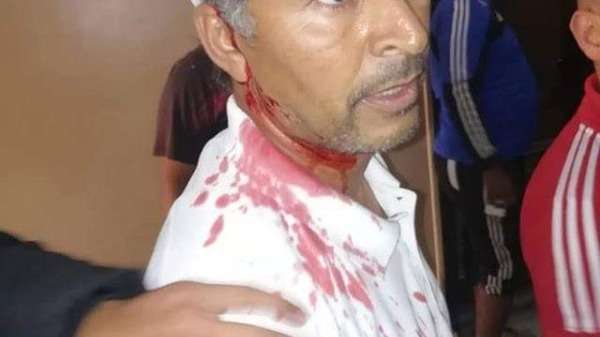 جانب من الإصابات