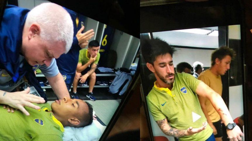 impactantes-boca_862x485