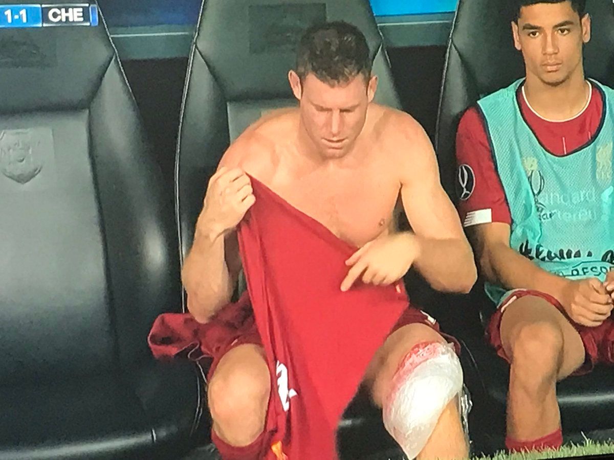 milner-injury
