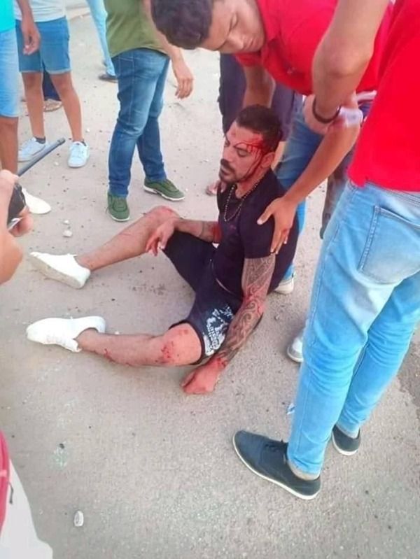 عمرو زكي بعد الحادث