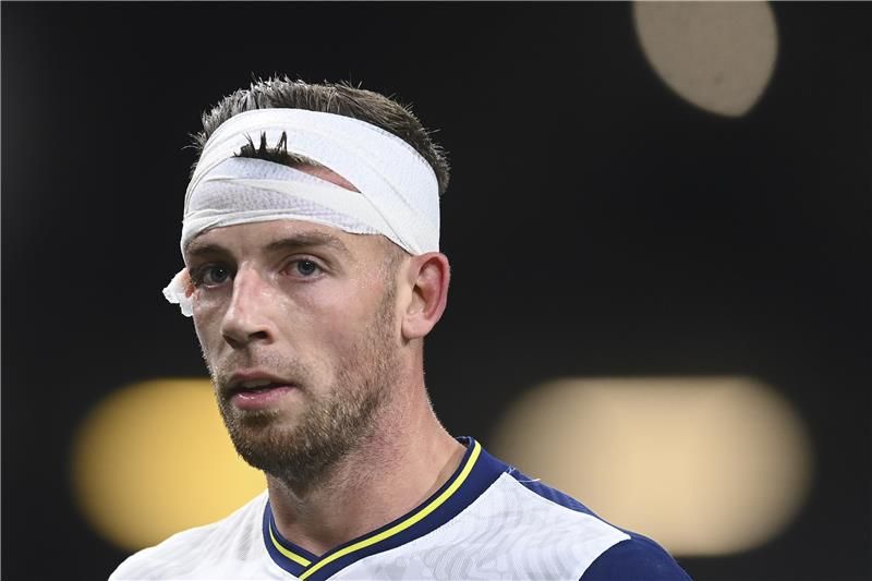 ألدرفيريلد 