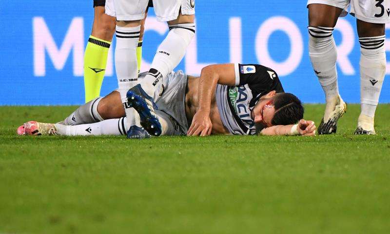 إصابة خطيرة بالرأس