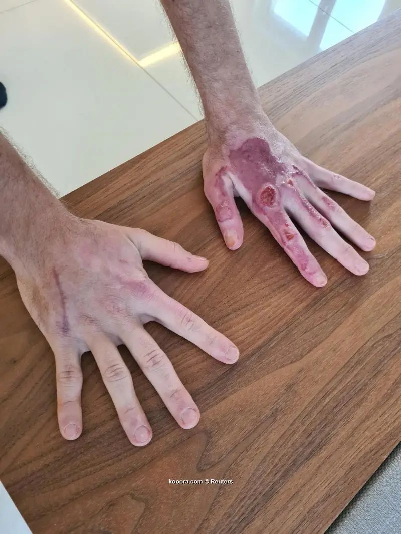 ?i=reuters%2f2021-01-12%2f2021-01-12t162840z_1163278076_rc2g6l9lv3d4_rtrmadp_3_motor-f1-grosjean_reuters